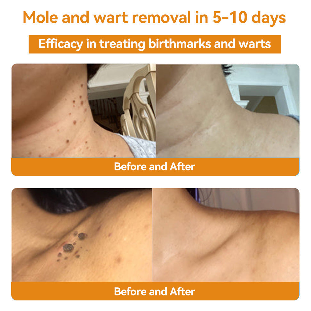 TLOPA® Bee Venom Skin Treatment Cream🌟(𝐵𝐴𝐷 𝑅𝑒𝑐𝑜𝑚𝑚𝑒𝑛𝑑𝑒𝑑)(🔥𝑳𝒂𝒔𝒕 𝒅𝒂𝒚 𝒑𝒓𝒐𝒎𝒐𝒕𝒊𝒐𝒏 70% 𝒐𝒇𝒇)