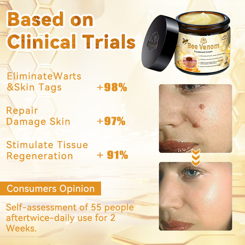 TLOPA® Bee Venom Skin Treatment Cream🌟(𝐵𝐴𝐷 𝑅𝑒𝑐𝑜𝑚𝑚𝑒𝑛𝑑𝑒𝑑)(🔥𝑳𝒂𝒔𝒕 𝒅𝒂𝒚 𝒑𝒓𝒐𝒎𝒐𝒕𝒊𝒐𝒏 70% 𝒐𝒇𝒇)