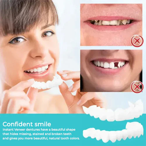 Seurico™ Adjustable Snap-On Dentures