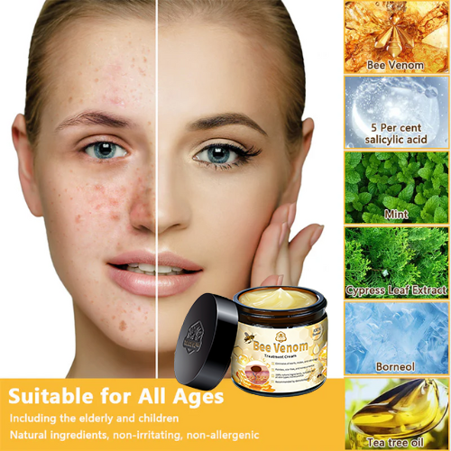 TLOPA® Bee Venom Skin Treatment Cream🌟(𝐵𝐴𝐷 𝑅𝑒𝑐𝑜𝑚𝑚𝑒𝑛𝑑𝑒𝑑)(🔥𝑳𝒂𝒔𝒕 𝒅𝒂𝒚 𝒑𝒓𝒐𝒎𝒐𝒕𝒊𝒐𝒏 70% 𝒐𝒇𝒇)