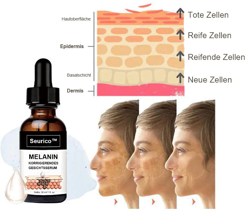 ✨Schneller Dunkelfleckentferner - Seurico™ Melanin Korrigierendes Gesichtsserum