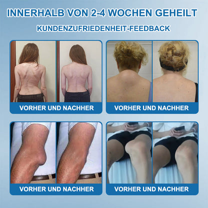 JEREMYTIS™ 𝐁𝐏𝐂-𝟏𝟓𝟕 𝐆𝐞𝐥𝐞𝐧𝐤𝐡𝐞𝐢𝐥𝐬𝐚𝐥𝐛𝐞 🦴 Behandelt Arthritis, Neuropathie, Rheuma, Sportverletzungen und mehr