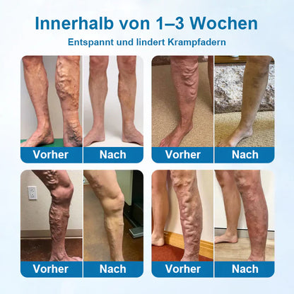 JEREMYTIS® VeinGuard Kräuterspray - ✅ Beseitigen Sie Krampfadern in nur 7 Tagen!
