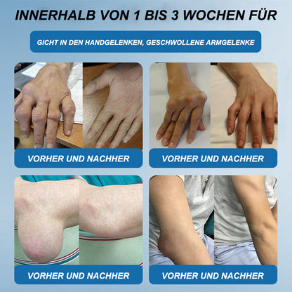 JEREMYTIS™ 𝐁𝐏𝐂-𝟏𝟓𝟕 𝐆𝐞𝐥𝐞𝐧𝐤𝐡𝐞𝐢𝐥𝐬𝐚𝐥𝐛𝐞 🦴 Behandelt Arthritis, Neuropathie, Rheuma, Sportverletzungen und mehr