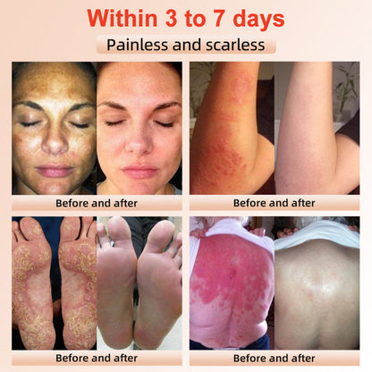 ✨[Offizieller Store] JEREMYTIS™ Peeling-Gel
