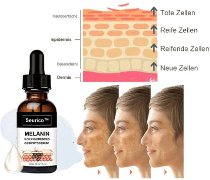 ✨Schneller Dunkelfleckentferner - Seurico™ Melanin Korrigierendes Gesichtsserum