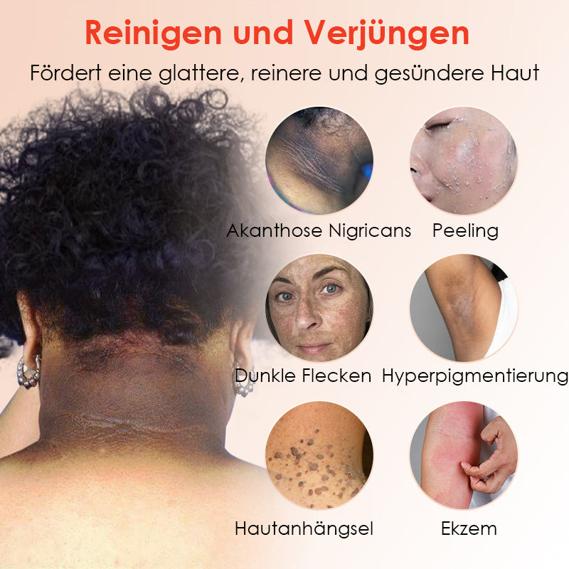 ✨[Offizieller Store] JEREMYTIS™ Peeling-Gel