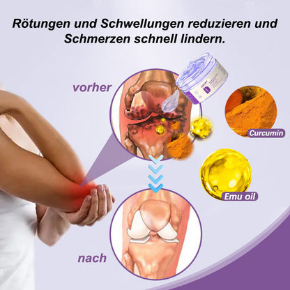 🔥ODEIUN™ AOA-zugelassenes Schmerzlinderungs-Gel